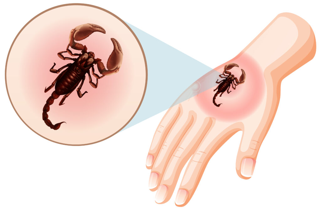 Doctor treating a snake bite patient at Thangam Hospital, Palakkad, equipped with advanced toxicology facilities.
