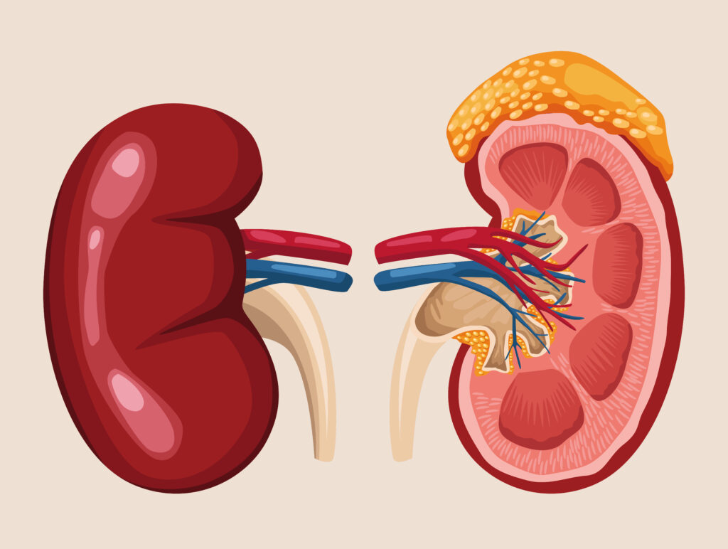KIDNEY DISEASE
